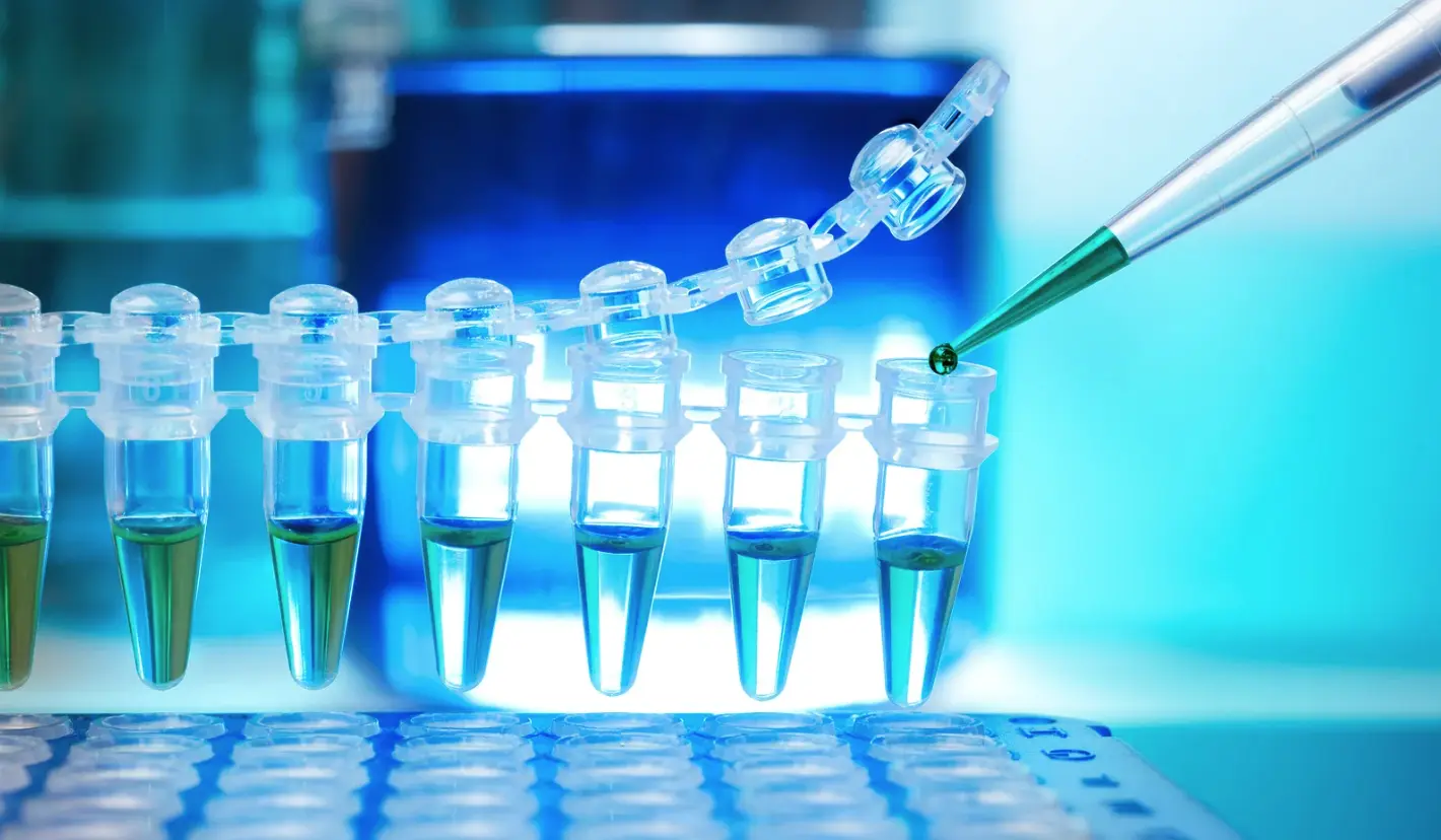 What is sample management?